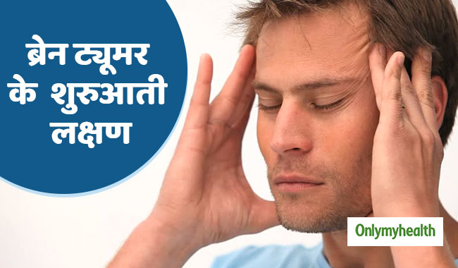 World Brain Tumour Day 2019: सिरदर्द, उल्टी और धुंधलापन हो सकता है ब्रेन ट्यूमर का शुरुआती लक्षण