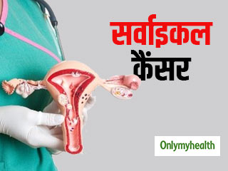 31 से 45 आयु की महिलाओं में सर्वाइकल कैंसर का खतरा ज्‍यादा: शोध  