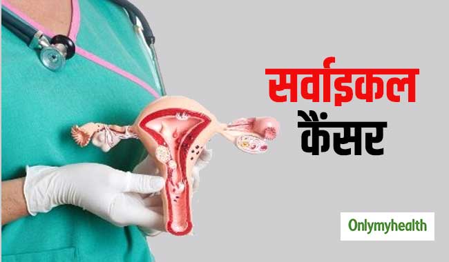 31 से 45 आयु की महिलाओं में सर्वाइकल कैंसर का खतरा ज्‍यादा: शोध  