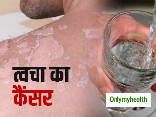दिल्ली में जल प्रदूषण से बढ़ रहा है त्वचा कैंसर का खतरा, जानें कैसे बचे इससे