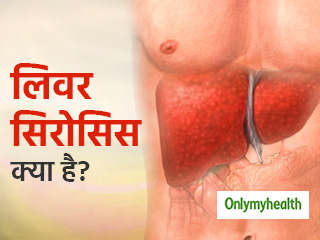 लिवर सिरोसिस का संकेत है पेट में सूजन और दर्द, जानें क्‍या है इस गंभीर बीमारी की वजह 