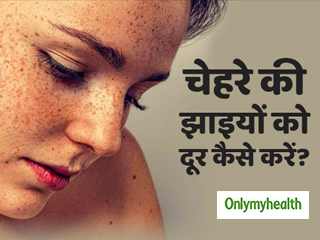 चेहरे की झाइयों को दूर करने के ये हैं 10 आसान उपाय, मिलेगा मेकअप वाला निखार 