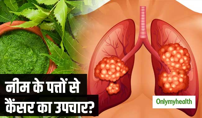 फोड़े-फुंसी से लेकर कैंसर तक को ठीक करते हैं नीम के पत्‍ते, जानें एक्‍सपर्ट की राय 
