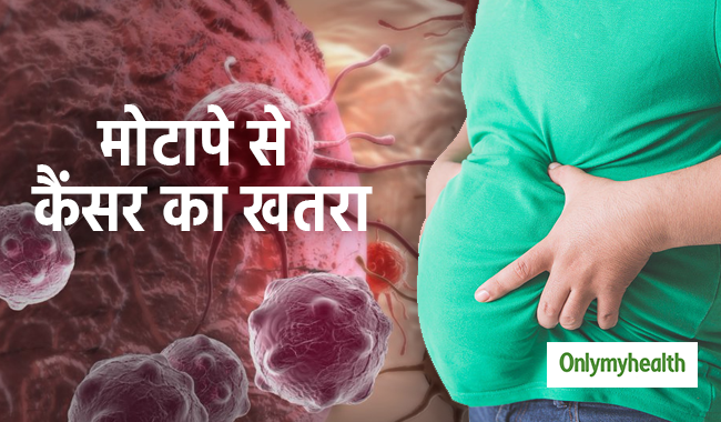मोटापा बन रहा है कम उम्र में कैंसर का कारण, एक्सपर्ट से जानें बचाव के तरीके