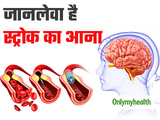 स्‍ट्रोक आने पर मस्तिष्‍क में रूक जाता है खून का प्रवाह, हाई ब्‍लड प्रेशर है इसकी वजह  