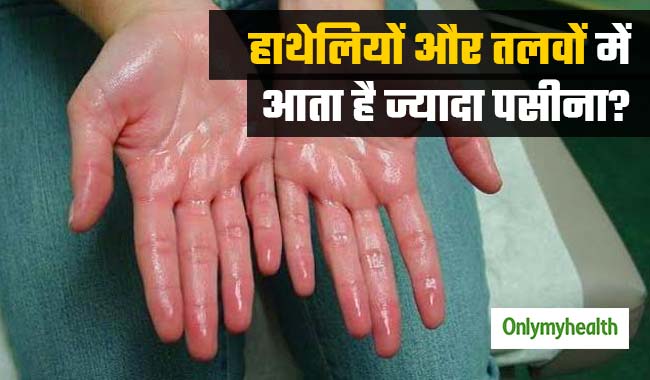 हाइपरहाइड्रोसिस रोग के कारण हाथेलियों और तलवों में आता है ज्‍यादा पसीना, जानें कारण और बचाव  