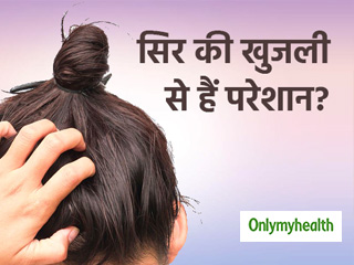 सिर में खुजली क्यों होती है? जानें कारण और खुजली दूर करने के 3 आसान नुस्खे