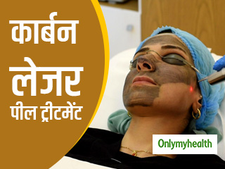 बोटोक्स से भी पावरफुल है कार्बन लेजर पील ट्रीटमेंट, झुर्रियां और दाग-धब्बे होते हैं एकदम गायब