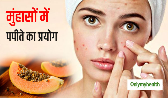 मुंहासे और दाग धब्‍बों से छुटकारा दिलाता है पपीते का ऐसा प्रयोग, चेहरे पर आता है ग्‍लो 