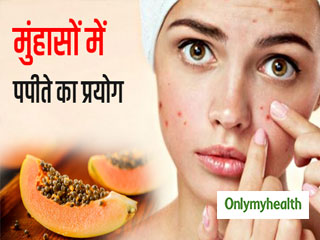 मुंहासे और दाग धब्‍बों से छुटकारा दिलाता है पपीते का ऐसा प्रयोग, चेहरे पर आता है ग्‍लो 