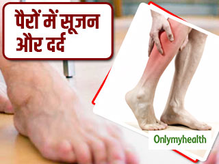 हाथ और पैरों की नसों में दर्द और सूजन हो सकता है डीवीटी रोग का संकेत