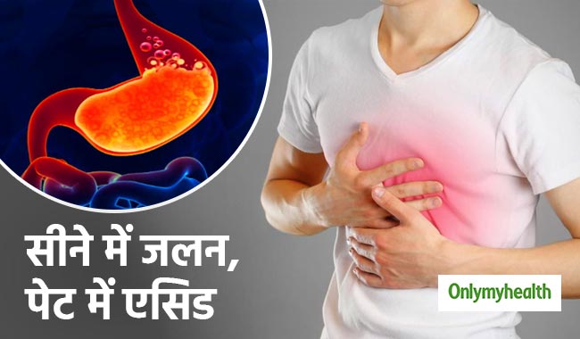 एसिड रिफलक्स के कारण हो सकती है सीने में जलन और दर्द की समस्या, जानें लक्षण