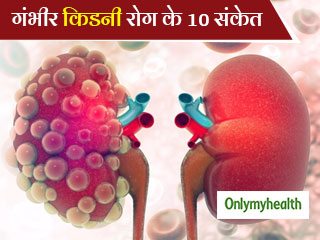 किडनी की गंभीर बीमारी का संकेत हैं ये 10 लक्षण, जानें क्यों खतरनाक है किडनी रोग