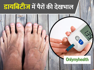 डायबिटीज में बंद हो सकती है पैरों में खून की सप्लाई, बदल जाती है त्वचा की रंगत