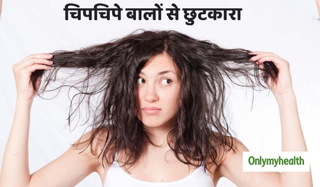 सर्दियों में चिपचिपे हो जाते हैं आपके बाल, तो इन 4 टिप्स की मदद से रखें ख्याल