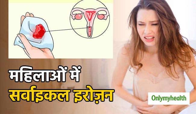 महिलाओं में खतरनाक रोग है सर्वाइकल इरोज़न, बार-बार पेशाब जाना भी है इसका लक्षण
