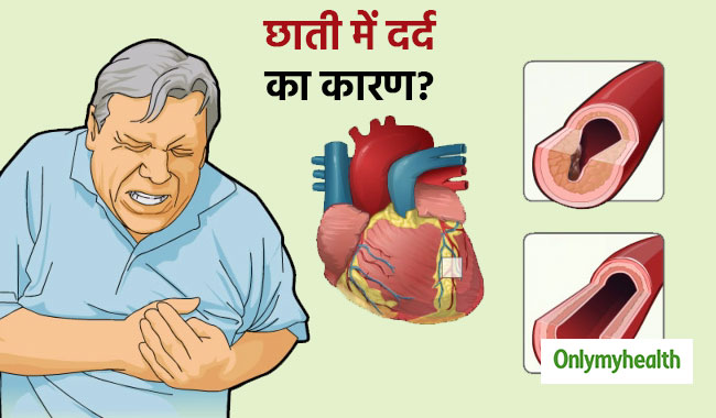 पुरुषों की छाती में होने वाला दर्द एनजाइना रोग के हैं संकेत, जानें क्‍या हैं इसके कारण और लक्षण