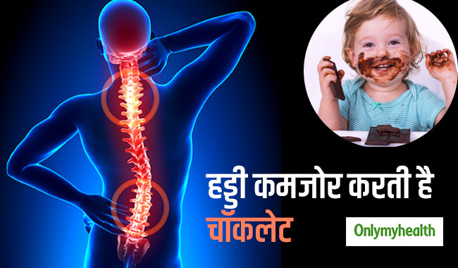ज्यादा चॉकलेट खाने से हड्डियां होती हैं कमजोर, डायबिटीज और एलर्जी का भी खतरा