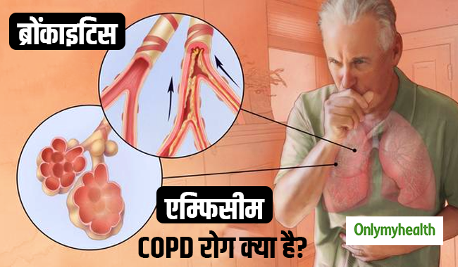 स्‍मोकिंग से महिला नहीं बल्कि पुरुषों को जल्‍दी होता है सीओपीडी रोग, जानें क्‍या है ये बीमारी और इसके लक्षण