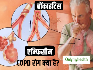 स्‍मोकिंग से महिला नहीं बल्कि पुरुषों को जल्‍दी होता है सीओपीडी रोग, जानें क्‍या है ये बीमारी और इसके लक्षण