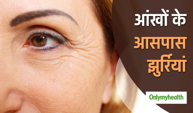 आंखों के आसपास हो गई हैं झुर्रियां? इन्हें हटाने के लिए घर पर ऐसे बनाएं खास सीरम