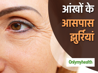आंखों के आसपास हो गई हैं झुर्रियां? इन्हें हटाने के लिए घर पर ऐसे बनाएं खास सीरम