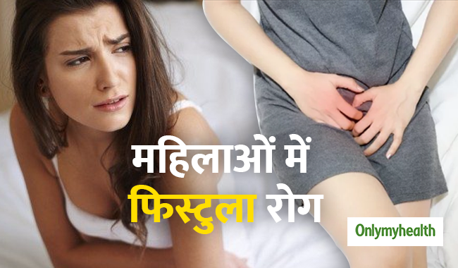 महिलाओं के गुदा मार्ग में फुंसियां होना फिस्टुला रोग का है लक्षण, जानें क्या है ये बीमारी