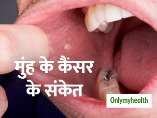 गाल में छाले और मुंह में घाव हैं मुंह के कैंसर के शुरुआती लक्षण, जानें किन्हें होता है खतरा