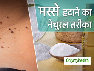 चेहरे के तिल और मस्सों को नैचुरल तरीके से दूर करने के 5 आसान घरेलू नुस्खे
