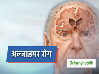 वैज्ञानिकों का दावा, अल्‍जाइमर रोगी की खोई हुई याददाश्‍त का वापस आना संभव  