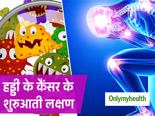 बहुत सामान्य हैं 'हड्डी के कैंसर' के शुरुआती संकेत, जोड़ों में दर्द और सूजन दिखे तो बरतें सावधानी