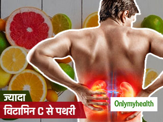 किडनी की पथरी का कारण बन सकता है ज्यादा 'विटामिन सी' का सेवन, जानें कारण