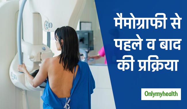 मैमोग्राफी से पहले और बाद में क्या करना चाहिए? जानें पूरी प्रक्रिया