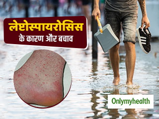बाढ़ और बारिश के पानी से हो सकती है लेप्टोस्पायरोसिस की समस्‍या, भुगतने पड़ सकते हैं गंभीर परिणाम