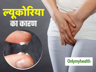ल्यूकोरिया (सफेद पानी) क्या है? जानें इसके 20 कारण और कुछ लक्षण 