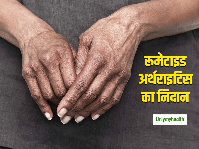 रूमेटाइड अर्थराइटिस का इलाज अब हुआ आसान! वैज्ञानिकों ने खोज निकाली है ये नई तकनीक
