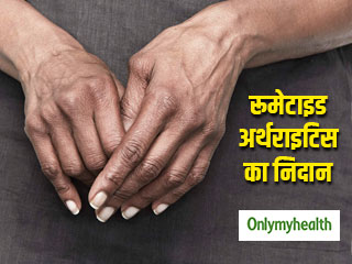 रूमेटाइड अर्थराइटिस का इलाज अब हुआ आसान! वैज्ञानिकों ने खोज निकाली है ये नई तकनीक