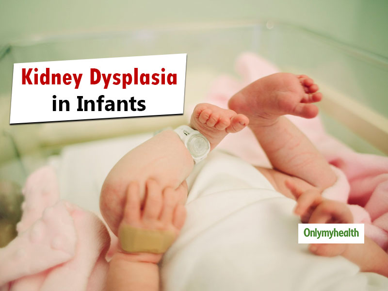 Infants In Womb Can Develop Kidney Dysplasia