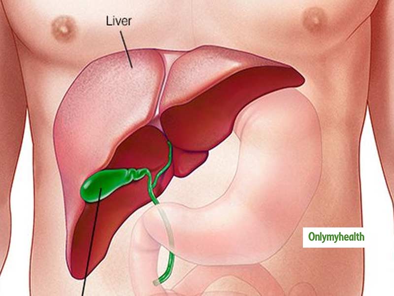 Liver Swelling Diet Chart