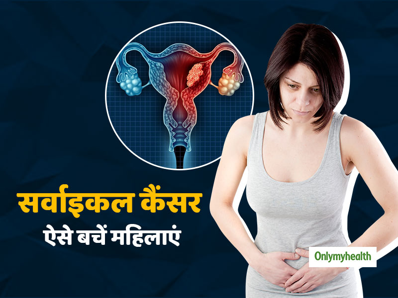 सर्वाइकल कैंसर से बचना है, तो महिलाओं को ध्यान रखने चाहिए ये 6 जरूरी टिप्स