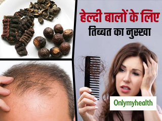 Tibetan Remedy for Hair Fall: गंजेपन और झड़ते बालों से हैं परेशान तो आजमाएं तिब्‍बत का ये नुस्‍खा, जरूर दिखेगा असर! 
