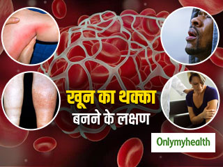 Blood Clot Signs: आपकी नस में बना खून का थक्का ला सकता है दिल का दौरा, जानें इसके 4 लक्षण