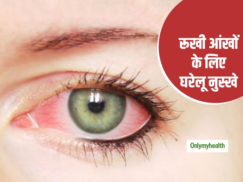 Dry Eye Syndrome: रूखेपन के कारण होती है जलन और आंखें लाल होने की समस्या, जानें 5 घरेलू उपचार