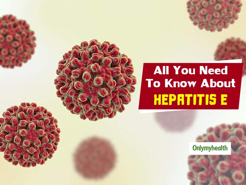 All About Hepatitis E: Symptoms, Causes And Treatment