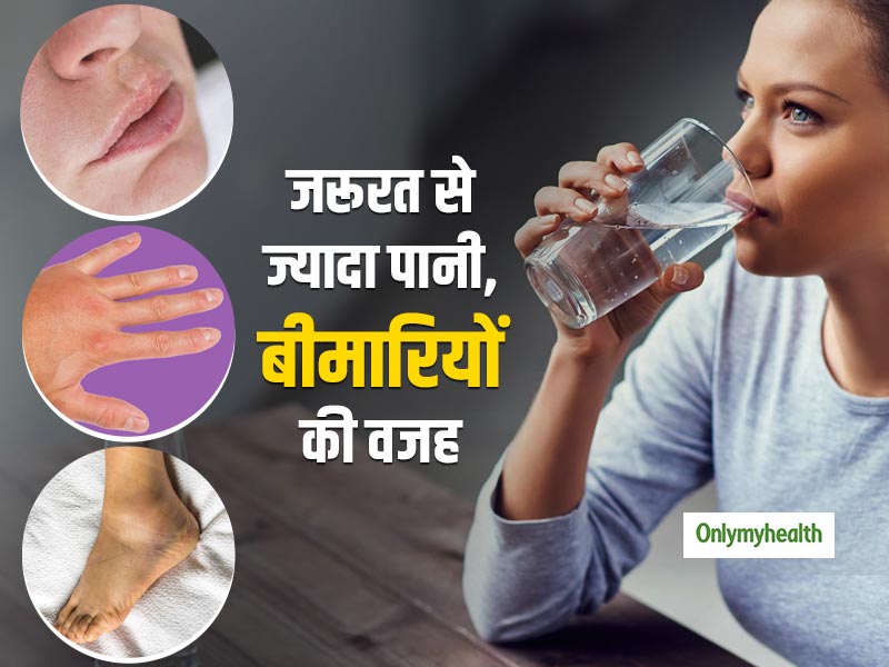 हाथ, पैर और होंठों पर सूजन का कारण है जरूरत से ज्यादा पानी पीना, हो सकती हैं ये 4 समस्याएं 
