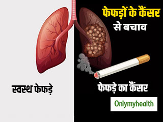 फेफड़ों के कैंसर से हर साल मरते हैं 60 लाख लोग, वजह है तम्‍बाकू! एक्‍सपर्ट से जानिए कैंसर के बचाव 