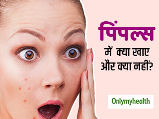 चेहरे पर पिंपल्स का कारण हो सकता है गलत खानपान, जानें पिंपल्स रोकने के लिए क्या खाएं, क्या नहीं?