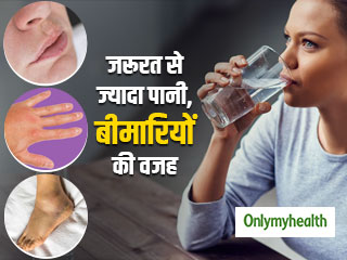 हाथ, पैर और होंठों पर सूजन का कारण है जरूरत से ज्यादा पानी पीना, हो सकती हैं ये 4 समस्याएं 