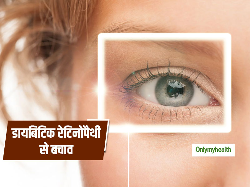 Diabetic Retinopathy: डायबिटीज में आंखों के धुंधलेपन यानि डायबिटिक रेटिनोपैथी से बचाव के 4 उपाय 