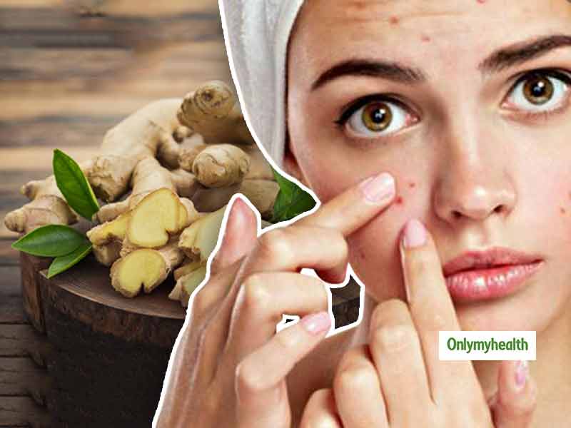 Beauty Tips : बालों और त्‍वचा के लिए फायदेमंद है अदरक, जानें प्रयोग का तरीका  